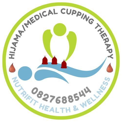 Hijama Cupping Therapy